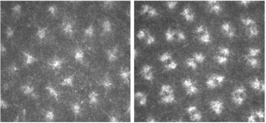 Cancer cells show supernumerary centrosome numbers 