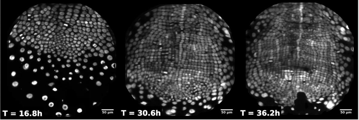 Light-sheet microscopy images of developing fourfold orientational order in Parhyale (Streichan Lab, UCSB)